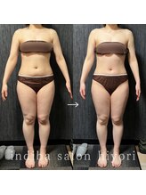 ヒヨリ(hiyori)/《before/after》body