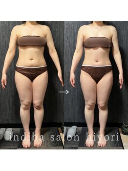 ヒヨリ(hiyori)/《before/after》body