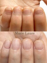 マリーロール 梅田店(Marie Laure)/深爪矯正/自爪育成/自爪風