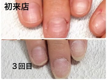 グレースレディ/3回でこの違い