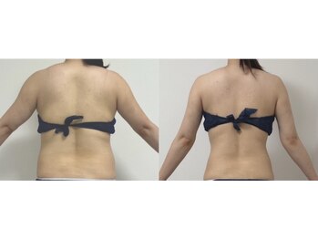 プリマルーチェ/プレミアム上半身プログラム