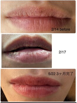 リュミエール デスポワール(Lumiere d'espoir)/ROMAPINK ローマピンク