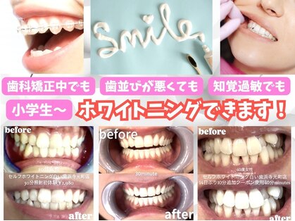 白い歯 浜寺元町店の写真