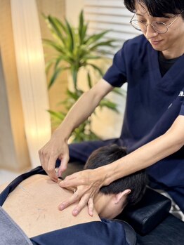 飯田橋駅前鍼灸整骨院/慢性的な凝りに【飯田橋/鍼灸】