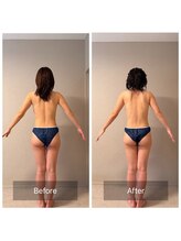 女神デトックス 西宮店(女神DETOX)/ビフォーアフター