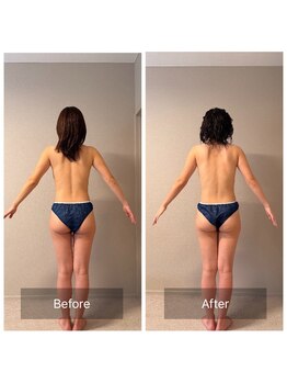 女神デトックス 西宮店(女神DETOX)/ビフォーアフター