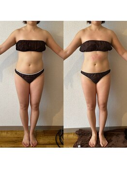 サロン マイワン(Salon MyONE)/全身ビフォーアフター正面