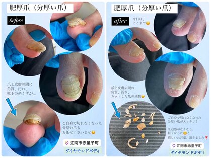 ダイヤモンドボディの写真