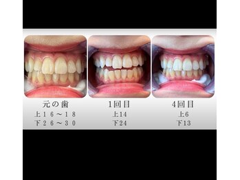 エクシアホワイト 福岡六本松/