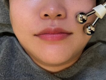 ほねつぎ一休さん 宇品店の写真/鍛えるだけじゃない。筋肉をゆるめて整えるリフトケア♪【たるみ/ほうれい線/むくみ/小顔】