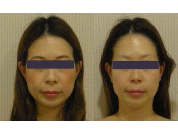 アルマ 芦屋(ALMA)/頭と顔のデトックスで印象激変☆