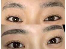 ノズ(NOZ)/まつ毛眉毛　Before/After