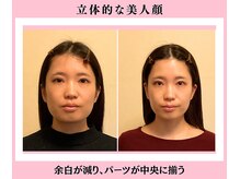 シエル(CIEL)/立体的な美人顔！パーツバランス