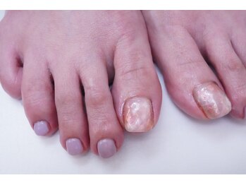 プチリリィ(Petit Lily)/淡い大人フットデザイン