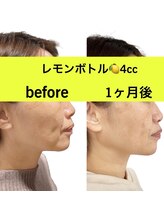 ララチッタ(L'la citta)/レモンボトル4cc