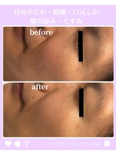 エイチ アンド イー(H&E)/