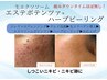 ◎本日限定！最新肌管理エステポテンツァ×ハーブピーリング¥22,000→
