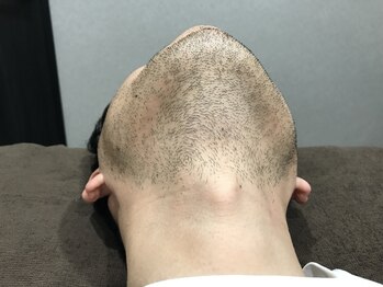 デサフィオ(Desafio.sln)の写真/【結果重視＆濃ゆい毛専門店★】男性もVIO含めた全身まるごとしっかり脱毛可能！満足度◎部分お試し¥1000