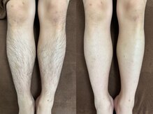 エゾンス(AISANCE)の雰囲気(数少ない【最新型LED脱毛器】を使用し女性と男性どちらも可能)