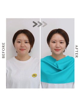 シュアリー(Surely)/トータルコースお客様事例