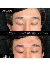 ユー 千葉駅前店(you)/ビフォ－アフター写真