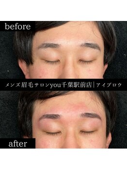 ユー 千葉駅前店(you)/ビフォ－アフター写真