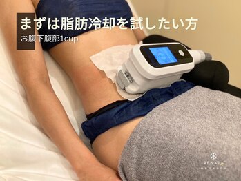 レナータ 銀座店(RENATA)/下腹部１カップ脂肪冷却