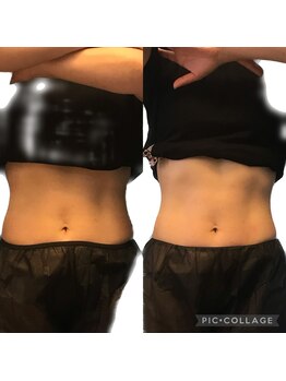 ヴァローレ(valore)/一回でこの変化☆腸もみ/リンパ