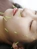 美容鍼灸全身コース　90分　