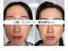 【韓国肌管理】無添加天然ハーブピーリング/剥離なし/肌艶UP/肌トラブル改善