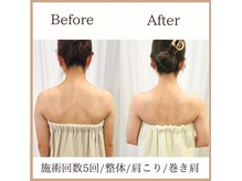 サロンルーチェ(Salon Luce)の雰囲気（ブライダル花嫁さま。肩甲骨を正しい位置へ。代謝向上/痩身整体）