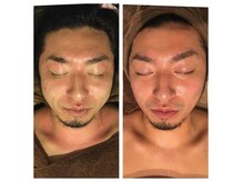 タイムレス バイ サロンリーナ(Timeless by salon Lena)の雰囲気（小顔矯正も行っております。お顔のむくみ改善に！）