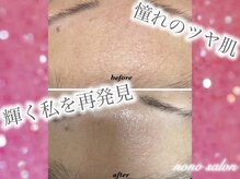 ノノサロン(nono salon)