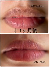 リュミエール デスポワール(Lumiere d'espoir)/ROMAPINK ローマピンク