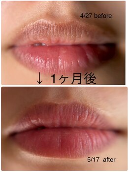 リュミエール デスポワール(Lumiere d'espoir)/ROMAPINK ローマピンク