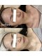 レアビューティー(Le'a beauty)の写真/お肌を綺麗にしたい方必見!《医療機関と提携するサロン》一人一人に合った施術をお悩み別にご提案します◎