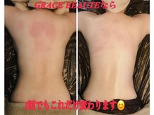 グレースボーテ(GRACE BEAUTE)/オールハンドマッサージ90分