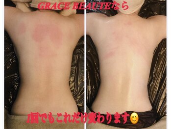 グレースボーテ(GRACE BEAUTE)/オールハンドマッサージ90分