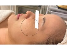 モネ(monet)/【after】