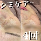 メディスキン ザ 銀座(MEDISKIN)