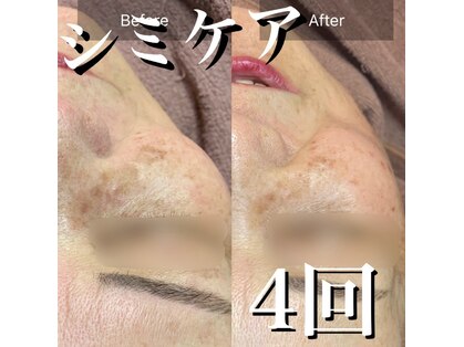 メディスキン ザ 銀座(MEDISKIN)の写真