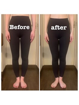 テイクオフ(Takeoff)/O脚改善/姿勢改善/根本改善/整体