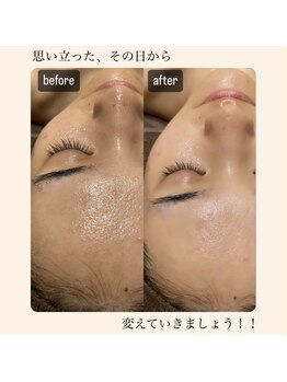 ディサイドロー(DECIDE L.A.W)/