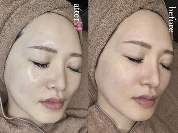 アイラッシュ アズリア(eyelash Azuria)/韓国肌公式認定サロンララピール