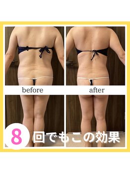 ソーレ(Sole)/セルゼロ2によるダイエット結果