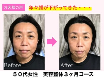 よしみち整体院/50代/小顔矯正後のお写真です