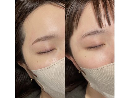 アイラッシュ ティル(eyelash till)の写真