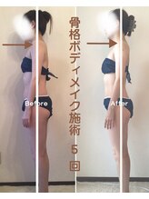 ハナ(hana)/毎日のロキソニンから解放！