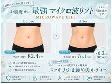 クロエビューティー 麻布十番店(クロエbeauty)の雰囲気(マイクロウェーブ/毛穴/ハーブピーリング/マイクロ波リフト)