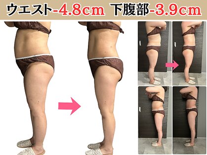 ヘッテ(Hette)の写真